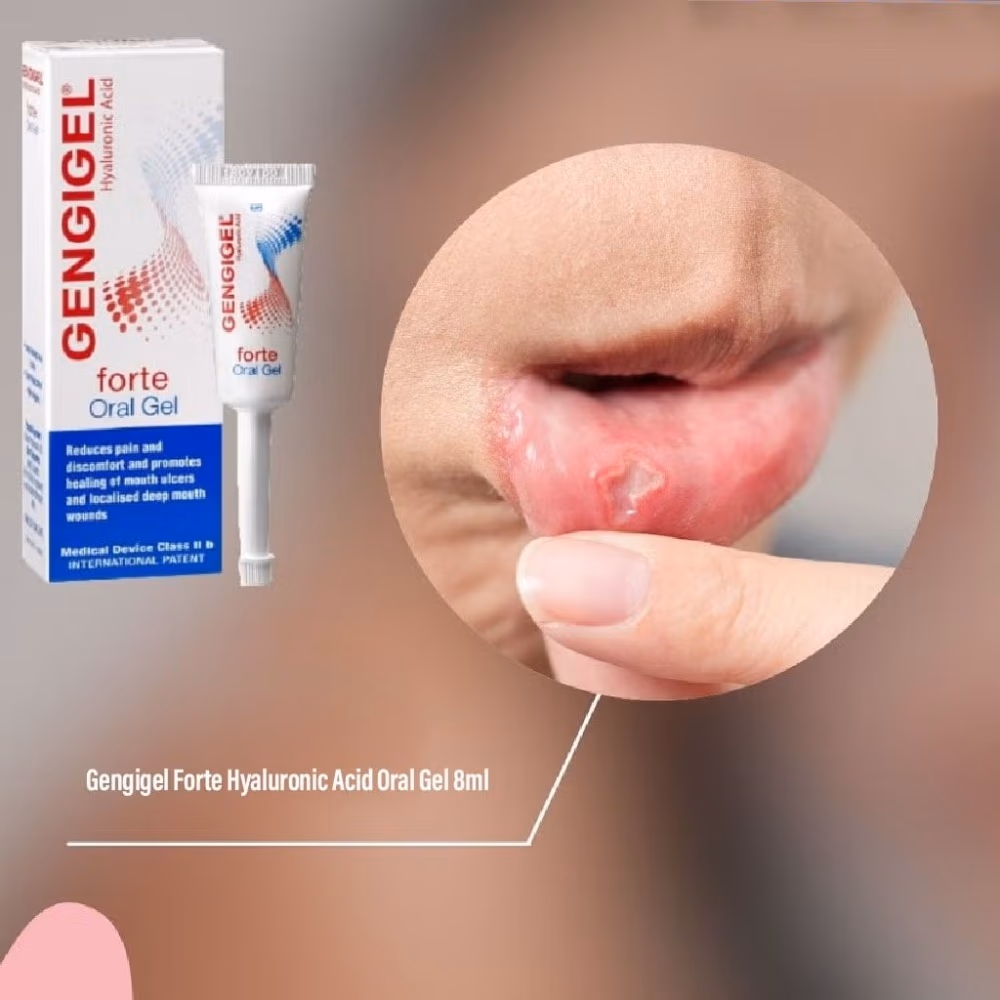 Gengigel Forte Oral Gel 8Ml 3