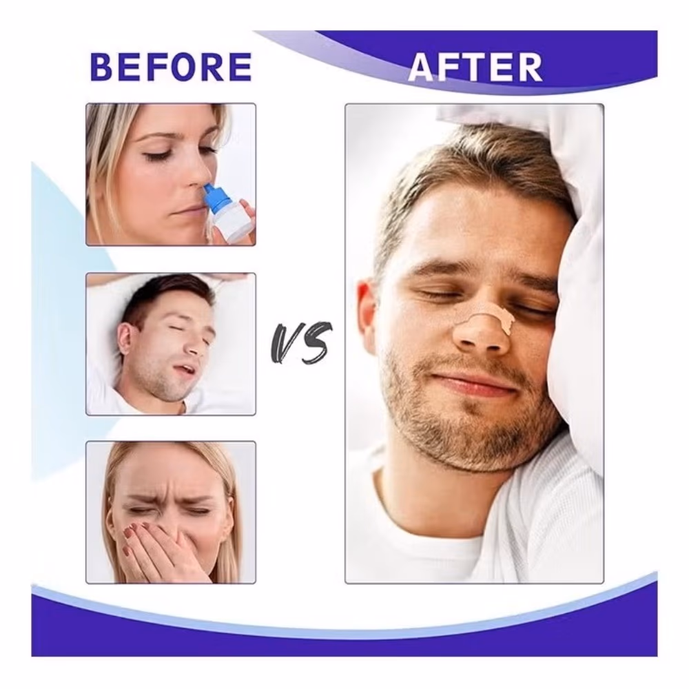 Ezycare Nasal Plasters 10S 5