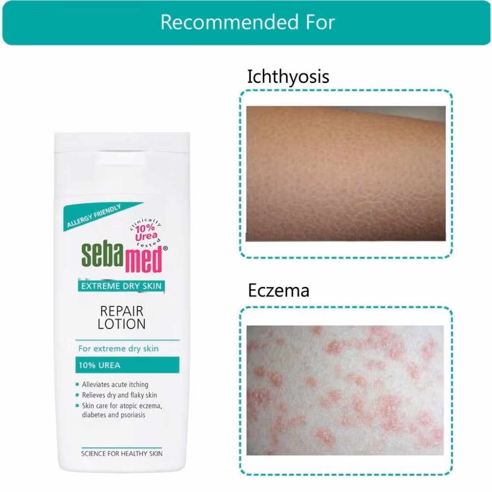 Sebamed 10% Urea Repair Lotion 4