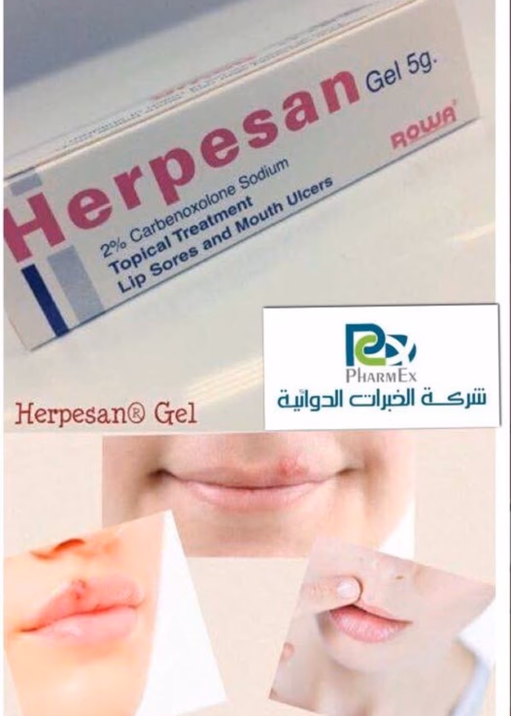 Herpesan Gel 5G 4