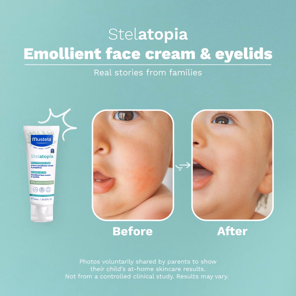 MUSTELA STELATOPIA EMOLLIENT FACE CRM 40ML 4