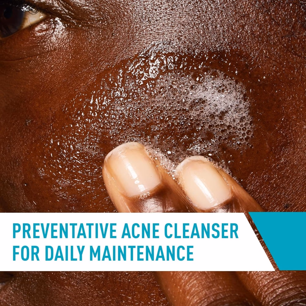 CeraVe Acne Control Cleanser – 473ml  4