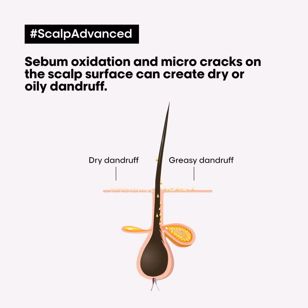 L'Oréal Serie Expert Scalp Advanced 2-in-1 Shampoo & Mask 250ml 2
