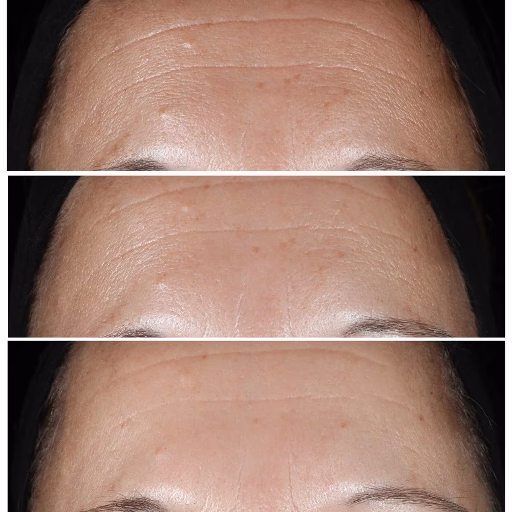 Clinique Smart Clinical Repair Wrinkle Correcting Serum – Anti-Aging Serum for Lines & Wrinkles 4
