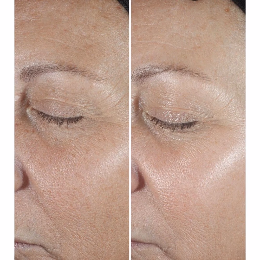 Clinique Smart Clinical Repair Wrinkle Correcting Serum – Anti-Aging Serum for Lines & Wrinkles 2