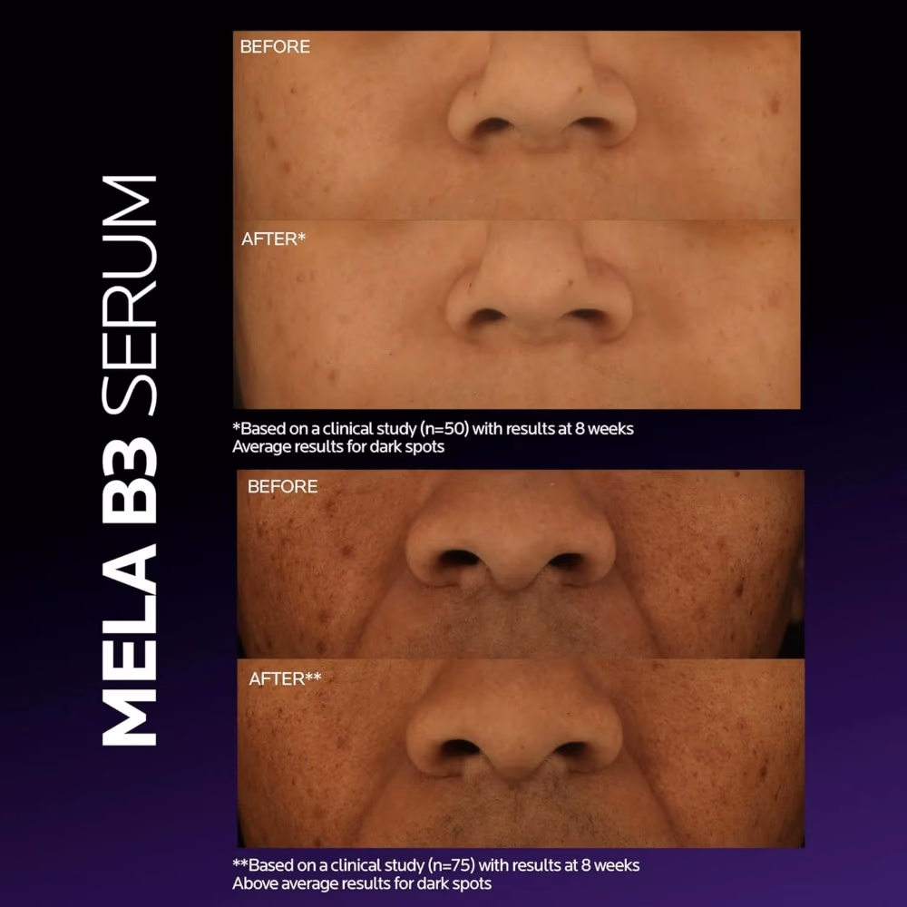 La Roche-Posay Mela B3 Serum Anti Dark Spot 30ml 5