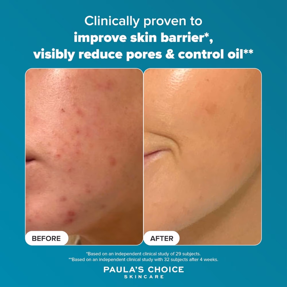 Paula's Choice Exfoliate 2% Bha Liquid Exfoliant 30ml 3