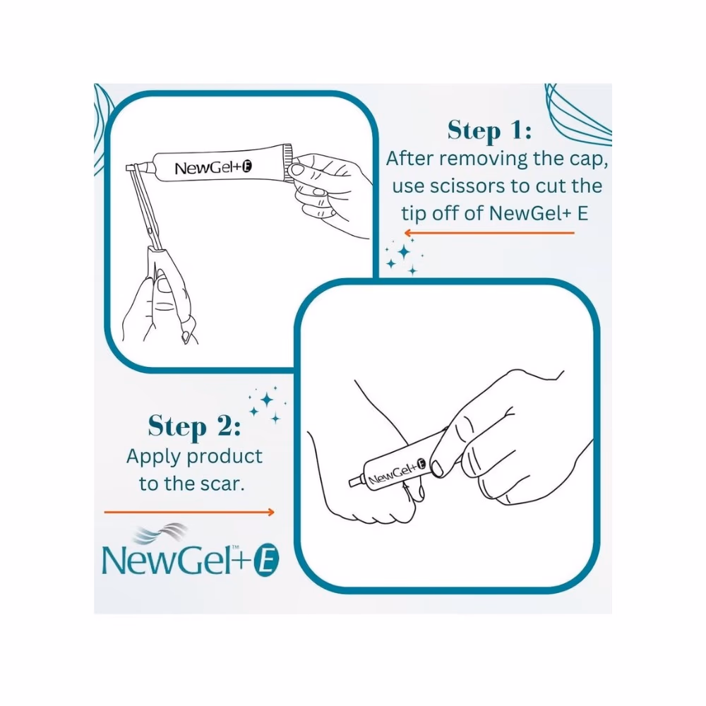 NewGel+E Silicone Scar Gel 3