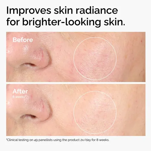 The Ordinary Alpha Arbutin 2% + HA - 30ml 4