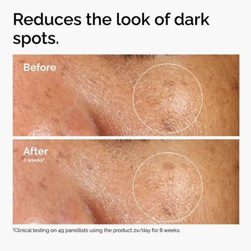 The Ordinary Alpha Arbutin 2% + HA - 30ml 5